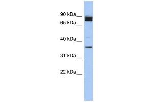 MGC48628 antibody used at 1 ug/ml to detect target protein. (MGC48628 (N-Term) anticorps)