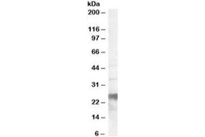 Western blot testing of human brain lysate with PrP antibody at 0. (PRNP anticorps)