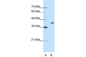 THEX1 antibody used at 2. (ERI1 anticorps  (C-Term))