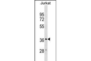 HMOX2 Antibody (N-term) (ABIN1539215 and ABIN2838325) western blot analysis in Jurkat cell line lysates (35 μg/lane). (HMOX2 anticorps  (N-Term))