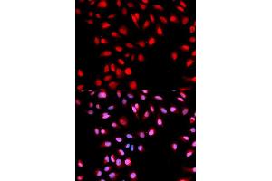 Immunofluorescence analysis of U2OS cells using Phospho-MET-Y1003 antibody (ABIN5969921). (c-MET anticorps  (pTyr1003))
