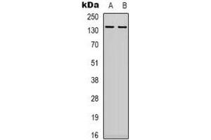 Western blot analysis of DNA Ligase 1 expression in 22RV1 (A), MCF7 (B) whole cell lysates. (LIG1 anticorps  (N-Term))