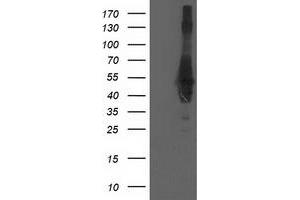 HEK293T cells were transfected with the pCMV6-ENTRY control (Left lane) or pCMV6-ENTRY CCM2 (Right lane) cDNA for 48 hrs and lysed. (CCM2 anticorps)