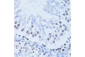 Immunohistochemistry of paraffin-embedded rat testis using PARP1 Antibody (ABIN5975769) at dilution of 1/100 (40x lens). (PARP1 anticorps)