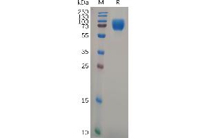 Human GHR Protein, hFc Tag on SDS-PAGE under reducing condition. (Growth Hormone Receptor Protein (GHR) (AA 27-264) (Fc Tag))