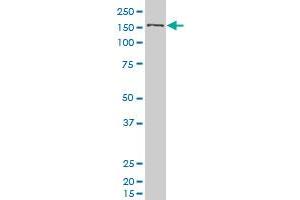 SMC1L1 polyclonal antibody (A01), Lot # 051003JC01 Western Blot analysis of SMC1L1 expression in 293 . (SMC1A anticorps  (AA 366-465))