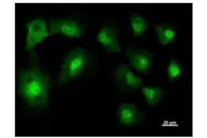 Immunostaining analysis in HT1080 cells. (NARS anticorps)