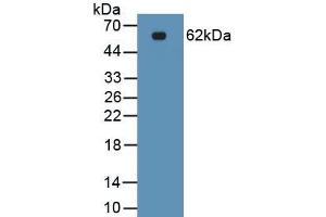 Detection of Recombinant EPCAM, Human using Polyclonal Antibody to Epithelial Cell Adhesion Molecule (EPCAM) (EpCAM anticorps  (AA 24-264))