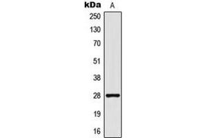 Western blot analysis of CD90 expression in MCF7 (A) whole cell lysates. (CD90 anticorps  (Center))