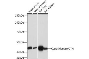 Western blot analysis of extracts of various cell lines, using Cystathionase/CTH Rabbit mAb (ABIN7266614) at 1:1000 dilution. (CTH anticorps)