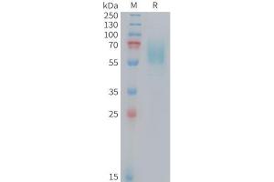 Mouse CD98 Protein, His Tag on SDS-PAGE under reducing condition. (SLC3A2 Protein (AA 100-526) (His tag))