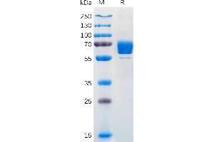 Human M-CSF Protein, mFc Tag on SDS-PAGE under reducing condition. (M-CSF/CSF1 Protein (AA 33-255) (mFc Tag))