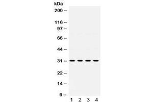 Western blot testing of 1) rat kidney, 2) rat liver, 3) human SGC and 4) human 22RV1 lysate with IGFBP3 antibody. (IGFBP3 anticorps)