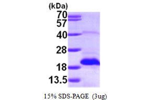 MSRB2 Protein (AA 21-182) (His tag)