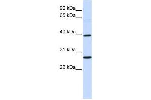 Western Blotting (WB) image for anti-Wingless-Type MMTV Integration Site Family, Member 16 (WNT16) antibody (ABIN2458569) (WNT16 anticorps)