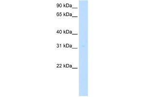 MLF2 antibody used at 5 ug/ml to detect target protein. (MLF2 anticorps  (Middle Region))