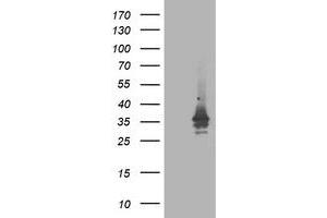 Western Blotting (WB) image for anti-ATG3 Autophagy Related 3 (ATG3) antibody (ABIN1496760) (ATG3 anticorps)
