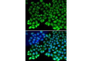 Immunofluorescence analysis of MCF7 cell using RPA1 antibody. (RPA1 anticorps)