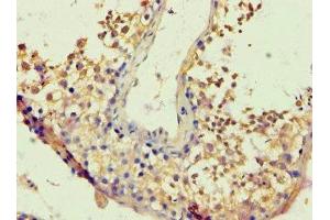 Immunohistochemistry of paraffin-embedded human testis tissue using ABIN7172717 at dilution of 1:100 (BACH1 anticorps  (AA 1-320))