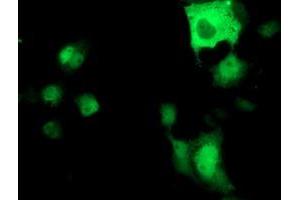 Immunofluorescence (IF) image for anti-ATPase, H+ Transporting, Lysosomal 56/58kDa, V1 Subunit B1 (ATP6V1B1) antibody (ABIN1496775) (ATP6V1B1 anticorps)