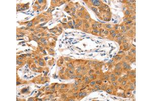 Immunohistochemistry (IHC) image for anti-NUAK Family, SNF1-Like Kinase, 1 (NUAK1) antibody (ABIN2432509) (NUAK1 anticorps)