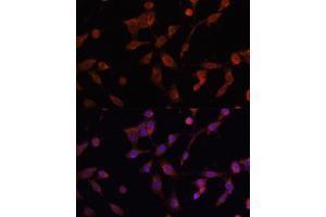Immunofluorescence analysis of NIH/3T3 cells using L antibody (ABIN6130048, ABIN6143079, ABIN6143080 and ABIN6215226) at dilution of 1:100. (LAMP1 anticorps  (AA 80-280))