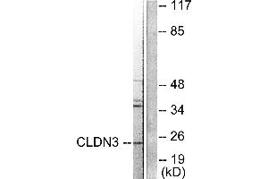 Western blot analysis of extracts from HuvEc cells, using Claudin 3 antibody. (Claudin 3 anticorps)