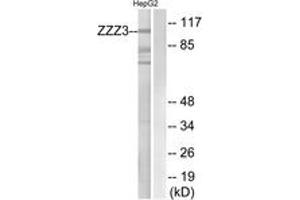 Western blot analysis of extracts from HepG2 cells, using ZZZ3 Antibody. (ZZZ3 anticorps  (AA 341-390))