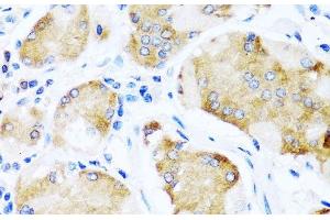 Immunohistochemistry of paraffin-embedded Human stomach using ACVR1C Polyclonal Antibody at dilution of 1:100 (40x lens). (ACVR1C/ALK7 anticorps)