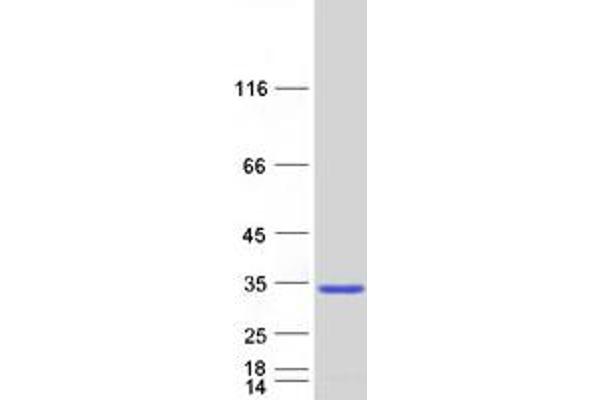 RNF141 Protein (Myc-DYKDDDDK Tag)