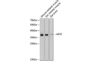 Western blot analysis of extracts of various cell lines using ART5 Polyclonal Antibody at dilution of 1:1000. (ART5 anticorps)