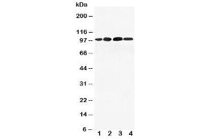 Western blot testing of Mineralocorticoid Receptor antibody and Lane 1:  293T (NR3C2 anticorps  (AA 966-984))