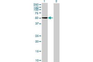 Lane 1: RBM23 transfected lysate ( 46. (RBM23 293T Cell Transient Overexpression Lysate(Denatured))