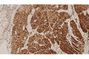 Human skeletal muscle: immunohistochemical staining of HAMLET: HAMLET: clone Ham1/7B6 (Dysferlin anticorps  (AA 1999-2016))