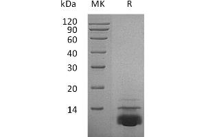 Greater than 95 % as determined by reducing SDS-PAGE. (CXCL5 Protéine)