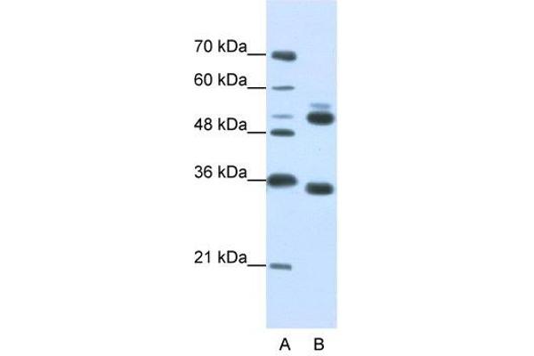 WDR6 anticorps  (C-Term)