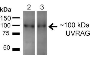 Western blot analysis of Human HeLa and 293T cell lysates showing detection of ~100kDa UVRAG protein using Rabbit Anti-UVRAG Polyclonal Antibody . (UVRAG anticorps  (Atto 488))