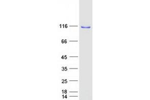 OSBPL6 Protein (Transcript Variant 1) (Myc-DYKDDDDK Tag)