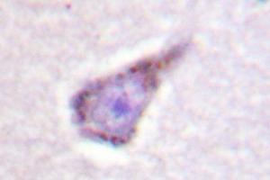 Image no. 2 for anti-Wiskott-Aldrich Syndrome (Eczema-thrombocytopenia) (WAS) antibody (ABIN272092) (WASP anticorps)