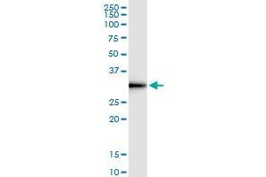 Immunoprecipitation of DNALI1 transfected lysate using rabbit polyclonal anti-DNALI1 and Protein A Magnetic Bead (DNALI1 (Humain) IP-WB Antibody Pair)