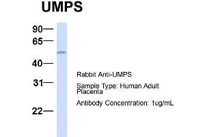 Host:  Rabbit  Target Name:  UMPS  Sample Type:  Human Adult Placenta  Antibody Dilution:  1. (UMPS anticorps  (C-Term))