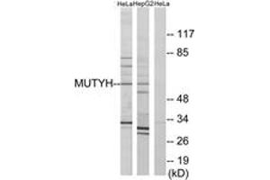 Western blot analysis of extracts from HeLa/HepG2 cells, using MUTYH Antibody. (MUTYH anticorps  (AA 151-200))