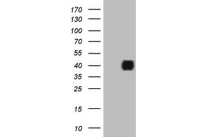 Western Blotting (WB) image for anti-Insulin-Like Growth Factor Binding Protein 3 (IGFBP3) (AA 28-297) antibody (ABIN2676357) (IGFBP3 anticorps  (AA 28-297))