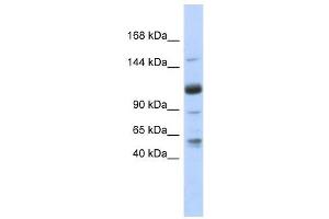 SR140 antibody used at 1 ug/ml to detect target protein. (SR140 anticorps  (N-Term))