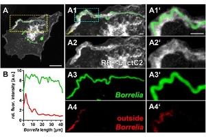 (A) Immunofluorescence micrographs of a primary macrophage expressing RFP–LactC2 (white), with internalized wild-type borreliae, stained by outside staining technique using Borrelia-specific antibody for antibody-accessible spirochetes (red), followed by permeabilization and staining of entire Borrelia cells. (Borrelia Burgdorferi anticorps)