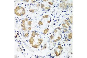 Immunohistochemistry of paraffin-embedded human stomach using OXCT1 antibody (ABIN5974499) at dilution of 1/100 (40x lens). (OXCT1 anticorps)