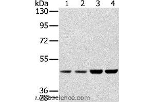 Western blot analysis of Hela, Raji, 231 and K562 cell, using SSB Polyclonal Antibody at dilution of 1:400 (SSB anticorps)