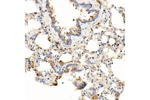 Immunohistochemistry of paraffin-embedded rat lung using [KO Validated] MyD88 Rabbit mAb (ABIN7268723) at dilution of 1:1000 (40x lens). (MYD88 anticorps)