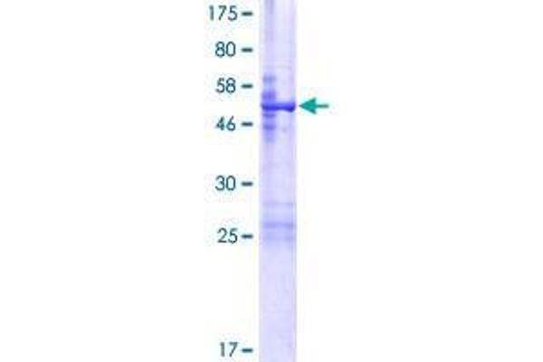 MVB12B Protein (AA 1-221) (GST tag)