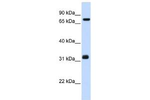 TCP10 antibody used at 1 ug/ml to detect target protein. (TCP10 anticorps)